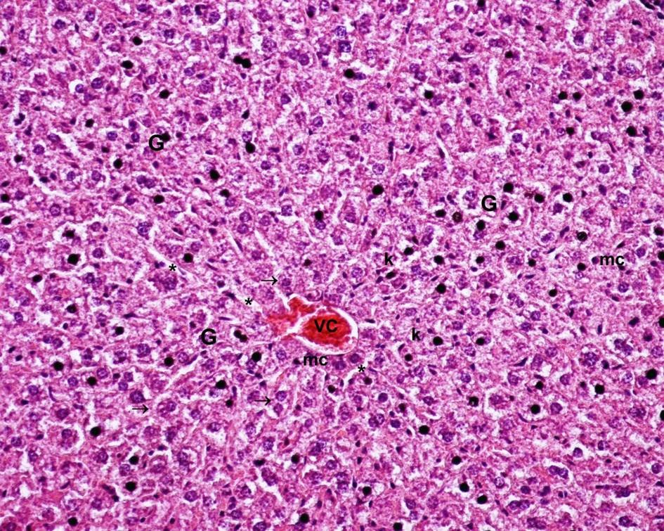 Light-microscopic view of hepatic tissue of Group DC (diabetes mellitus control)-figure-1