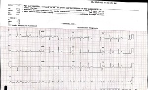 lead-ecg-after-starting-figure-3